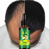 NATURAL 7 DAY HAIR GROWTH SERUM